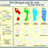 Affiche déviations du pied plastifiée, 40 x 60 – Image 2